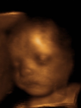 Our photo